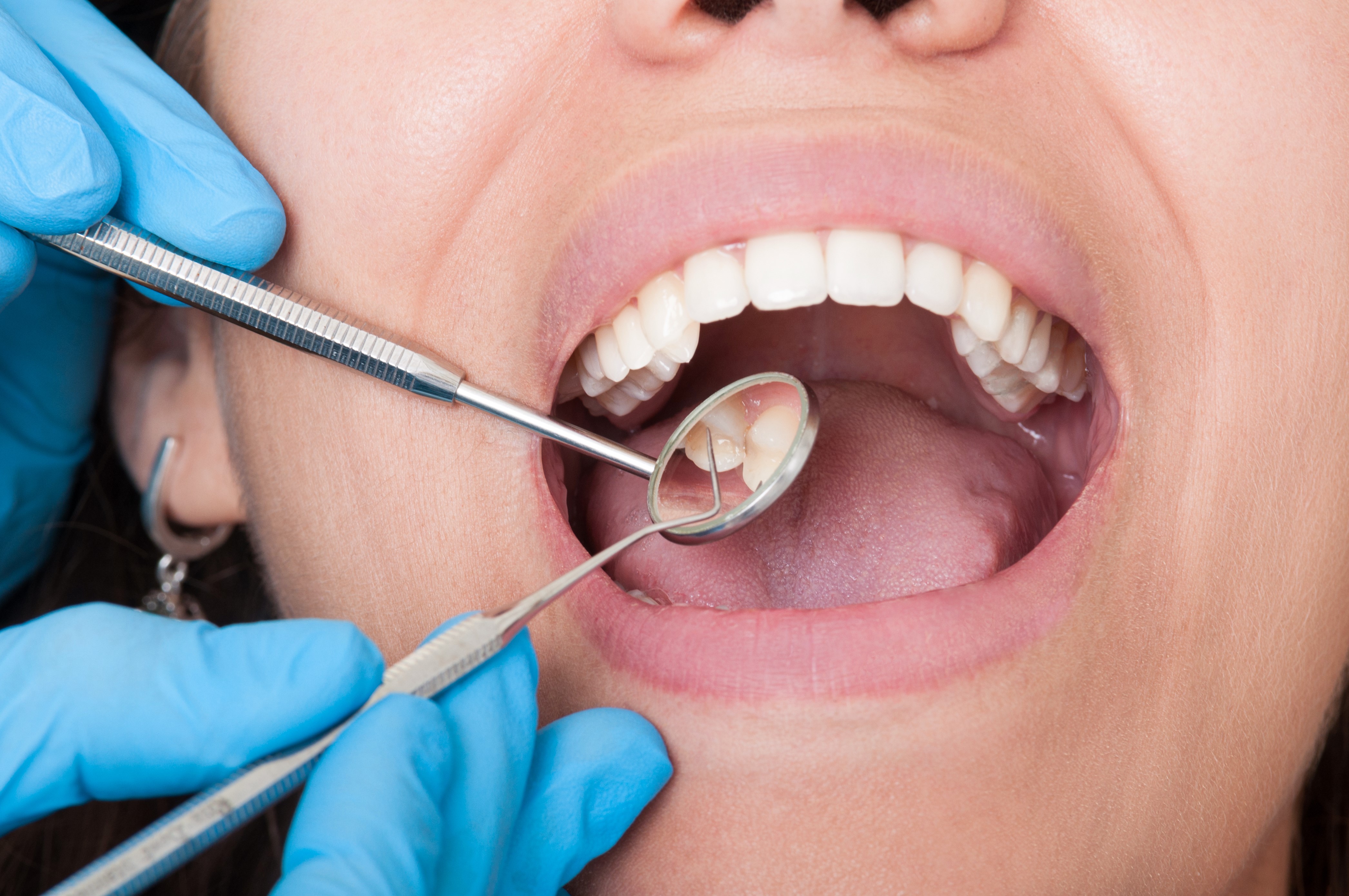 Dental Malpractice information you should know